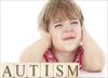 تحقیق درباره بیماری اوتیسم یا اتیسم- autism
